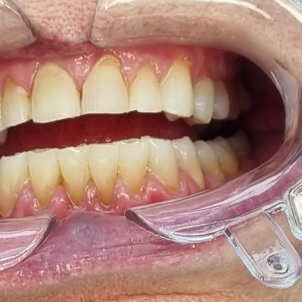 hygine_service hygine_service