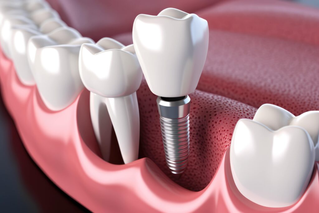 dentures-implant-banner-image