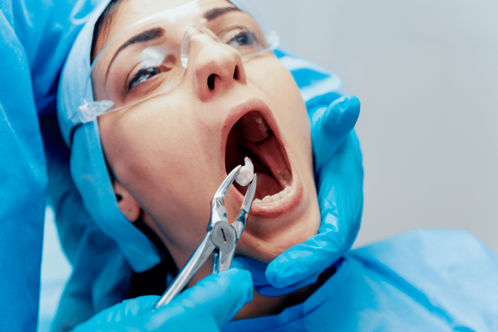 Extractions
